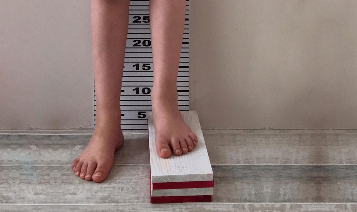 Bacak kısalığı 7