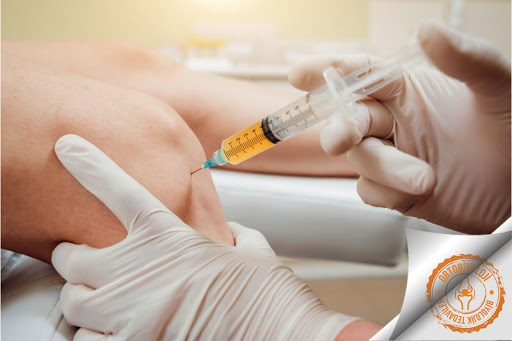 Diz kireçlenmesine prp tedavisi 1