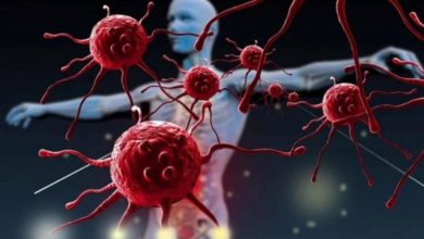 Kanserde erken teşhis hayat kurtarır 5