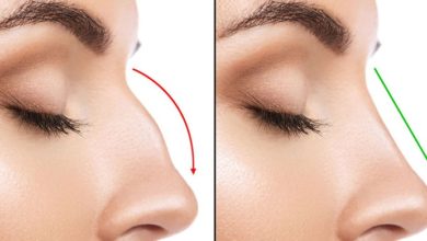 Ameliyatsız burun estetiği olabilirsiniz. 1