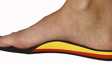 Ayakta kavus ( pes cavus ) deformitesi 1