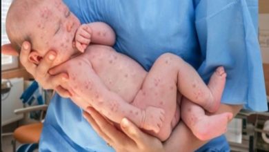 Aşı karşıtları lütfen tekrar tekrar düşünün 1