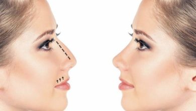 Burun estetiği sonrasında makyaj yapılabilir mi? 20