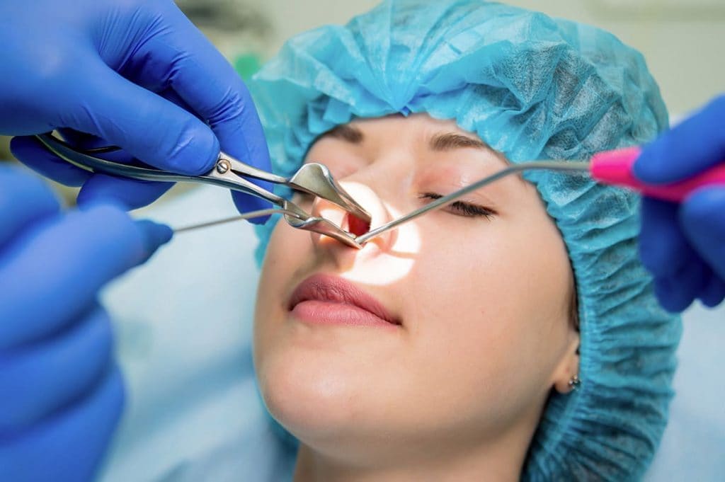 Burun eti konka ameliyatı nedir? 7