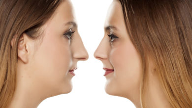 Burun ucu estetiği nasıl olmalıdır? 11