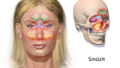 Burun – sinüs ameliyatları 1