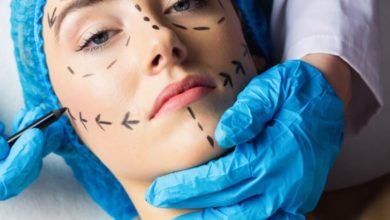 Fonksiyonel burun estetiği 1