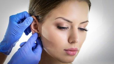 Otoplasti (kulak estetiği) 1