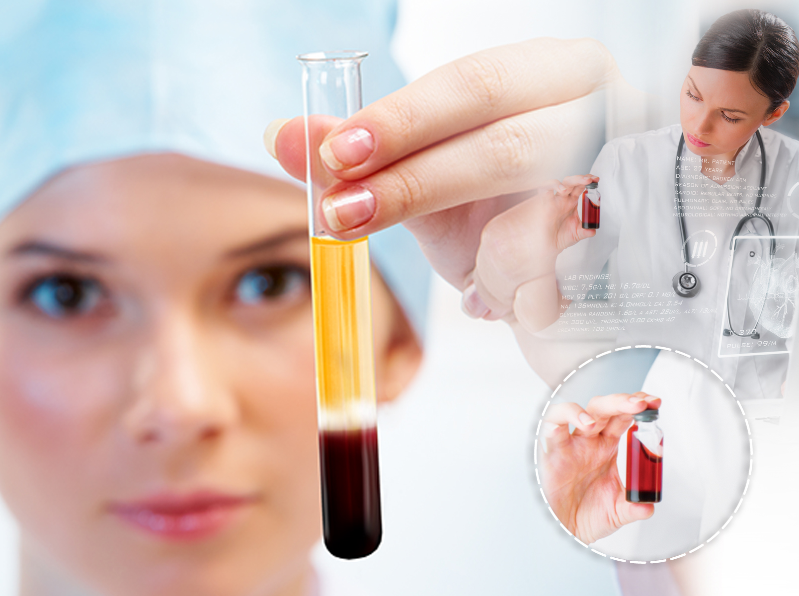 Prp (platelet rich plasma)​ tedavisi — haber görseli