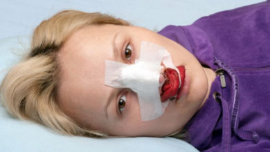 Burun ameliyatlarında kanama 5