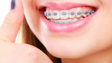 Erişkin Ortodontisi 1