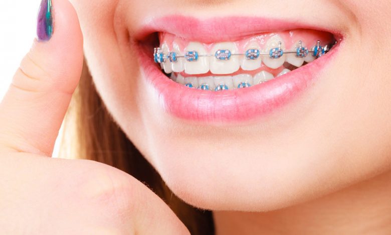 Erişkin Ortodontisi 7