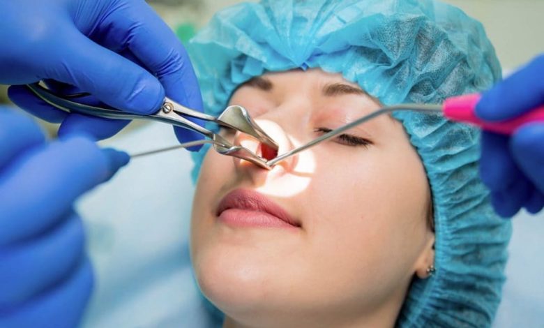 Burun estetiği ameliyatı nasıl yapılır ? 7