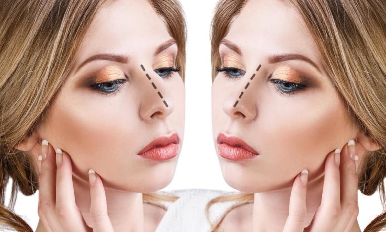Burun estetiği (rinoplasti) nedir? Septorinoplasti nedir? 6