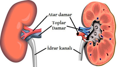 Laparoskopi – böbrek kanseri 5