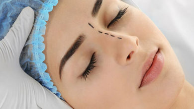 Burun estetiği ile ilgili sıkça sorulanlar 1