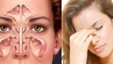 Burun ve burun boşluğu tümörleri 17