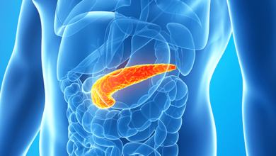 Pankreas Kanseri Nedir ? 1