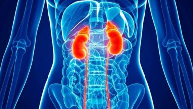 Böbrek kanseri (tümörü) 7