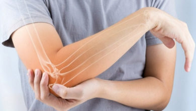 Tenisçi dirseğinde Akupunktur tedavisi 1