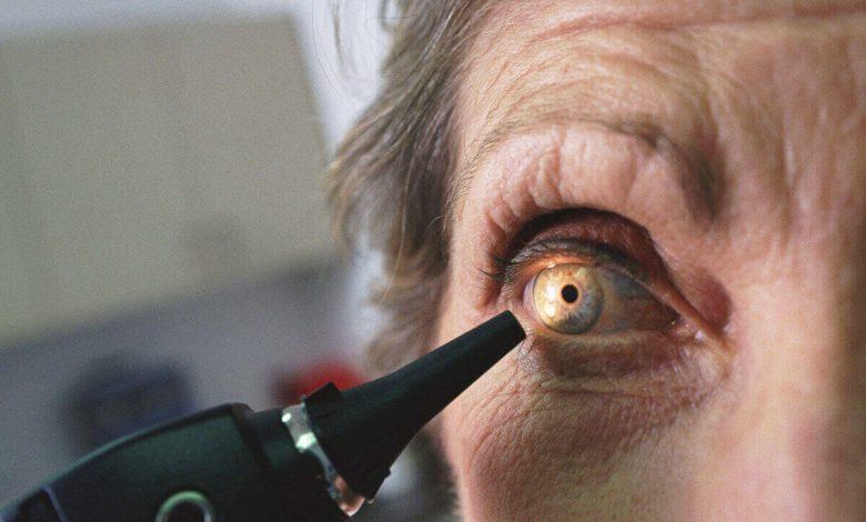 Sarı Nokta Hastalığı (Yaşa Bağlı Makula Dejenerasyonu) Nedir? 7