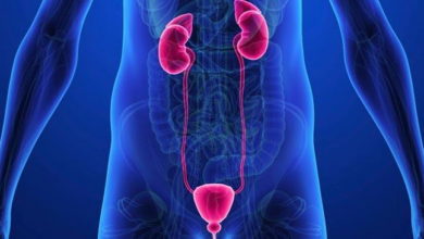 Ürolojide Lazer Kullanımı 13