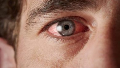 Göz İçi Tümörlerde Oluşan Belirtiler 7