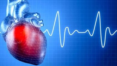 Elektrofizyolojik Çalışma 3