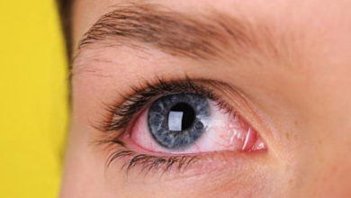 Göz İçi Tümörlerin Belirtileri Nelerdir? 1