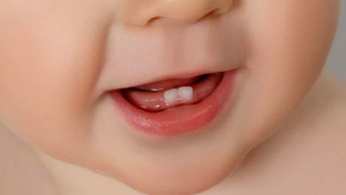 Süt Dişleri Neden Önemlidir? 21