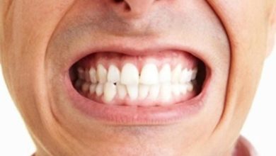 Bruksizm (Diş Sıkma, Gıcırdatma) 1