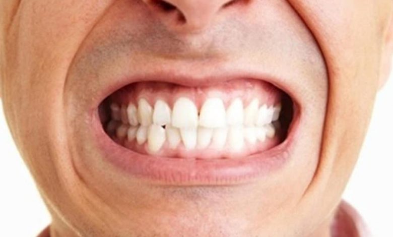 Bruksizm (Diş Sıkma, Gıcırdatma) 7