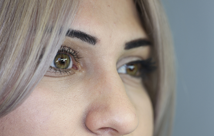 Protez Gözle Doğal Görünüm Mümkün ! 6