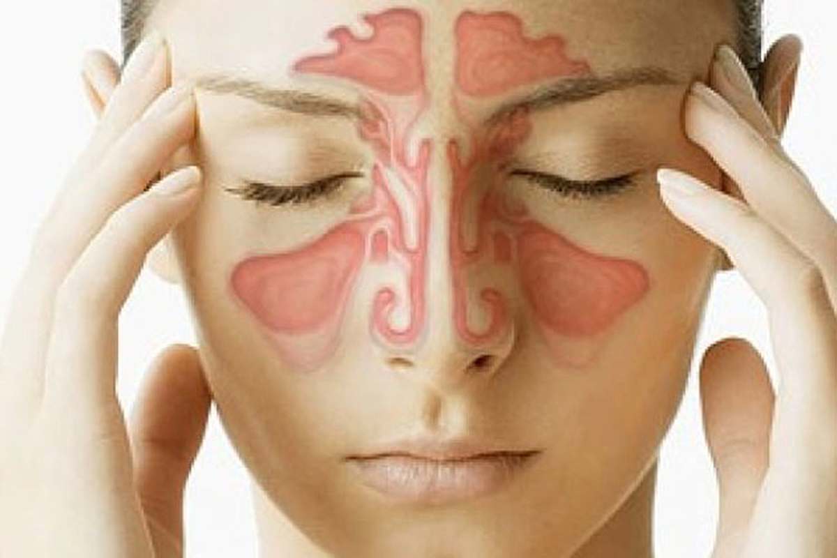 Endoskopik Sinüs Cerrahisi Nedir? 7