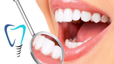 İmplant Diş Hakkında Merak Ettikleriniz 1