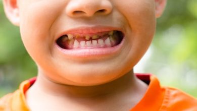 Çocuklarda Diş Kırıkları ve Acil Önlemler! 1