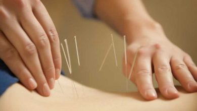 Niçin akupunktur tedavisi ? 26