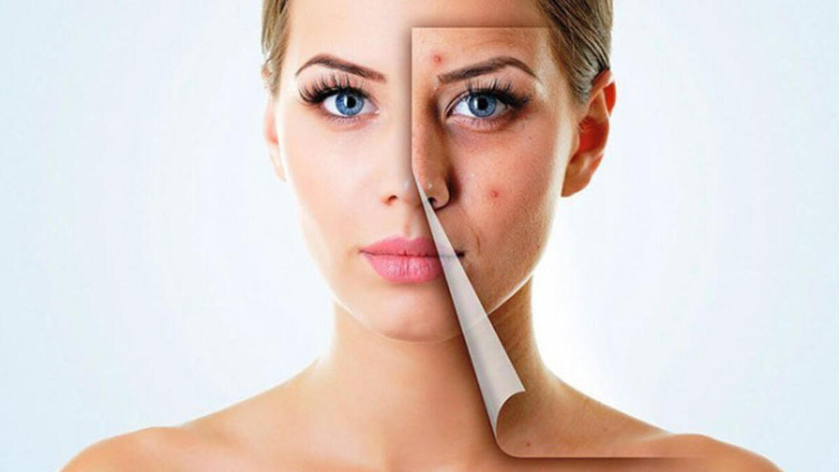 Cilt problemleri kaderiniz olmasın ! 7