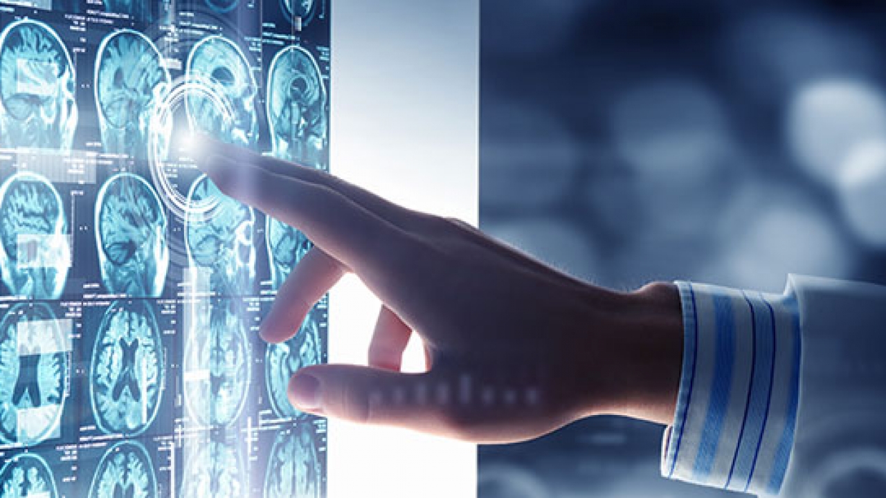 Als hastalığı (Amyotrophic Lateral Sclerosis) nedir? 7