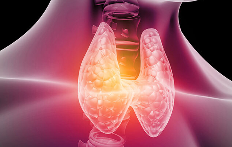 Haşimato hastalığı nedir? Neden olur ve belirtileri nelerdir? 6