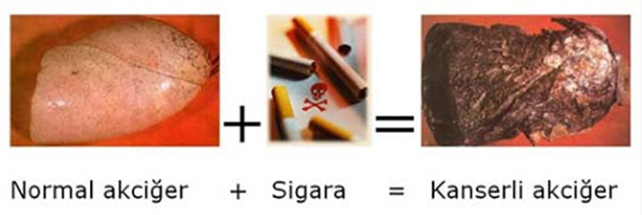 Sigara ve zararları 3