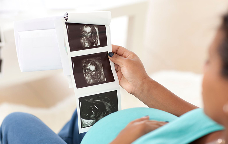 Doğacak Çocuğunuzun Sağlığı Sizin Elinizde 7