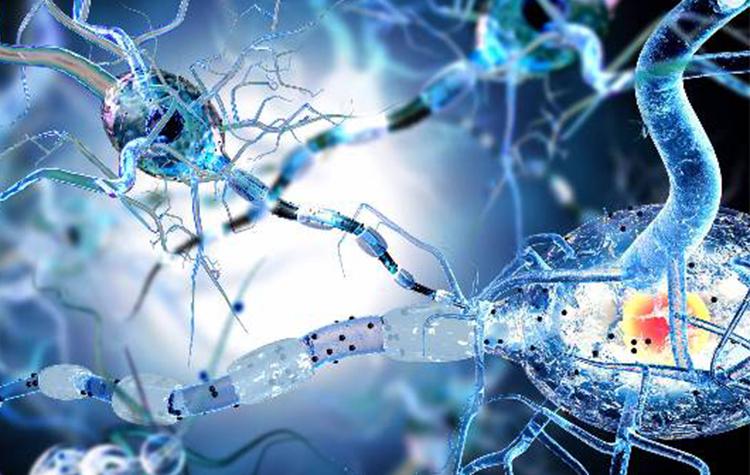 Alzheimer riskini düşürün! 7