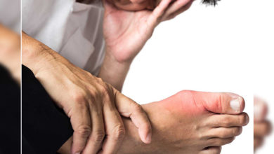 Gut Hastalığı Nedir? Belirtileri ve Tedavi Yöntemleri Nelerdir? 1