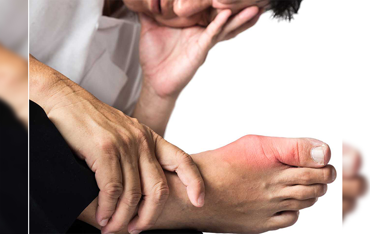 Gut Hastalığı Nedir? Belirtileri ve Tedavi Yöntemleri Nelerdir? 7