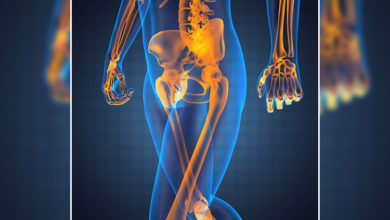 Çocuklardaki büyüme ağrıları sarkom ile karıştırılmamalı 3