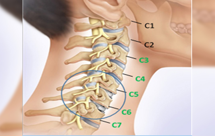 Позвоночника с3 с6. Протрузия c7-th1. Межпозвонковые диски c5 c6 c7. 3 4 5 Шейные позвонки. Шейный отдел с4 с5.
