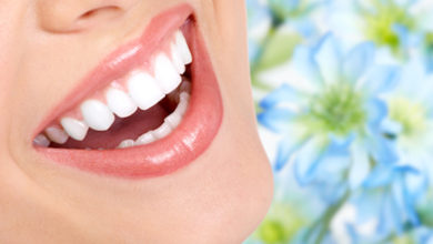 Gülüş tasarımı ile mutlu gülüşler ! 14