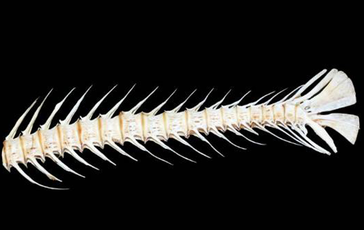 Kireçlenme için neler yapılabilir? 6