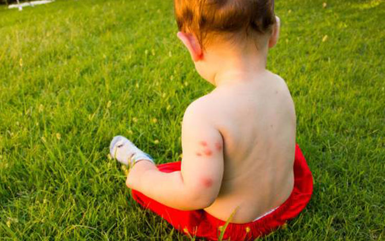 Böcek ısırması ne zaman tehlikelidir? 1